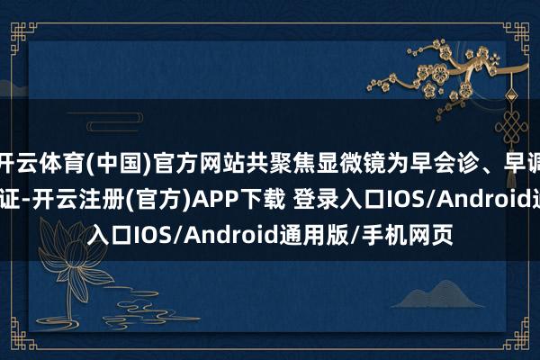 开云体育(中国)官方网站共聚焦显微镜为早会诊、早调养提供了更多保证-开云注册(官方)APP下载 登录入口IOS/Android通用版/手机网页